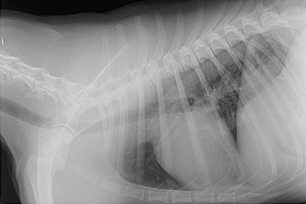 Radiology - thoracic